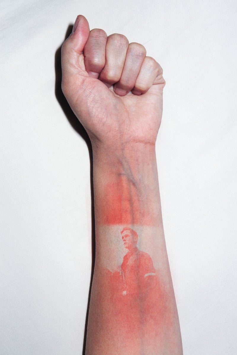 an arm with a photo 'sunburnt' onto it with a UV light